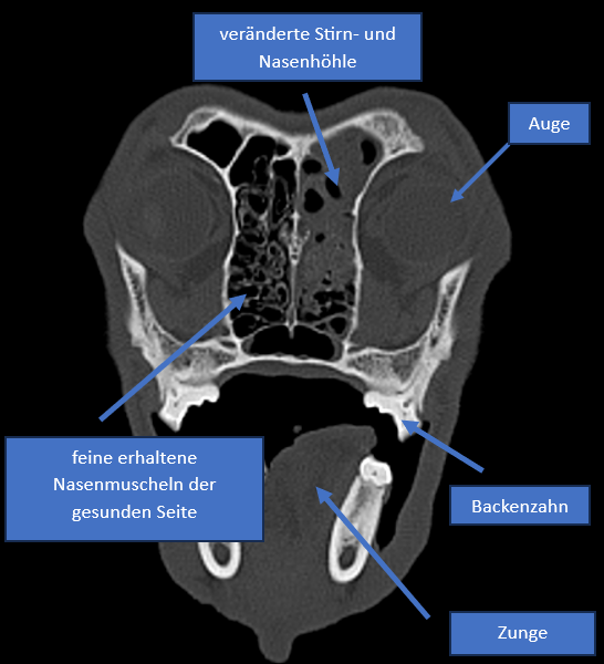 Nur ein Schnupfen?